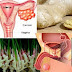 One Common Spice Fights Ovarian And Prostate Cancer Away Without The Damage Brought By Chemotherapy